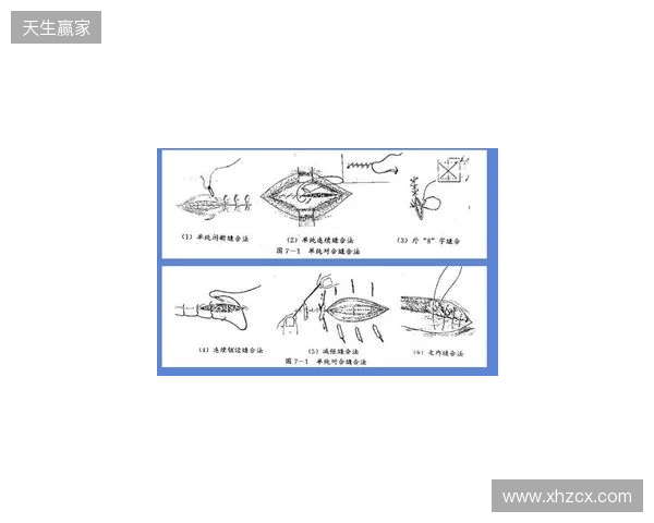 广州豹官方：杨浩眉弓伤口缝合30余针，预计5-7天后拆线
